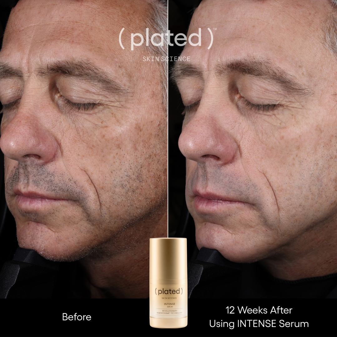 INTENSE Before + After 2