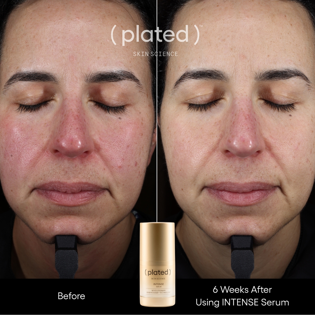 INTENSE Before + After